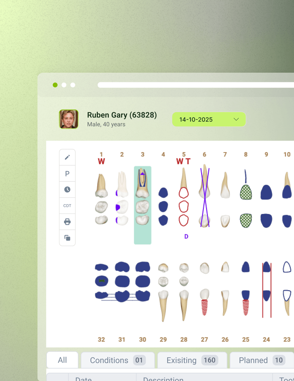 Graphical Odontogram