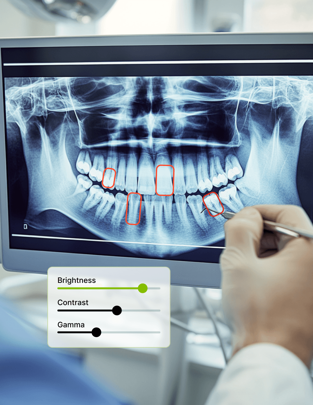 A dentist examines a dental X-ray on a monitor, highlighting teeth with red rectangles. Adjustments for brightness, contrast, and gamma are visible.