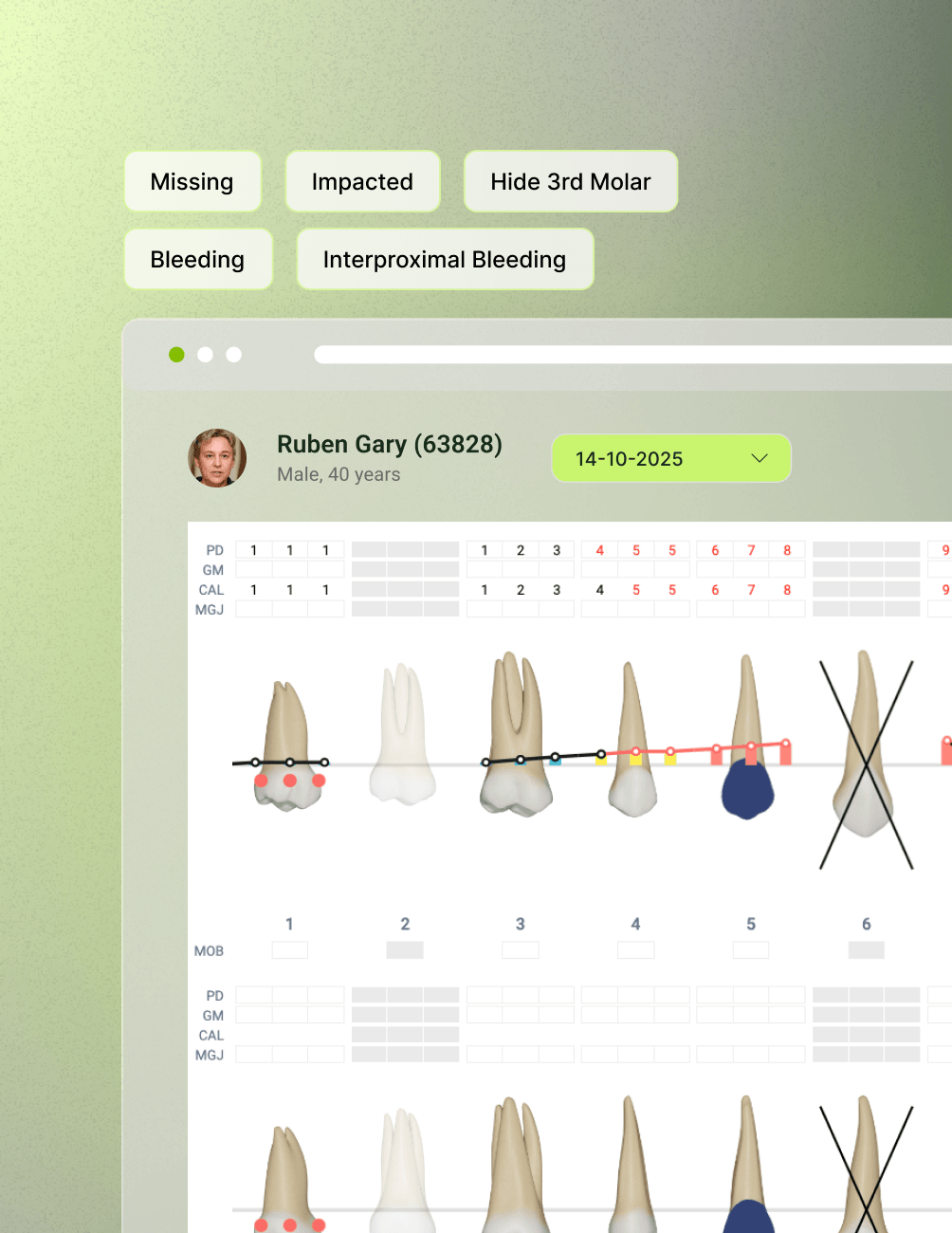General & Periodontal Charting