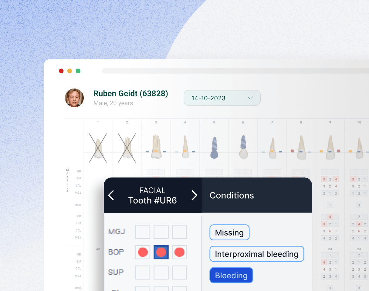 Simplify Perio Charting