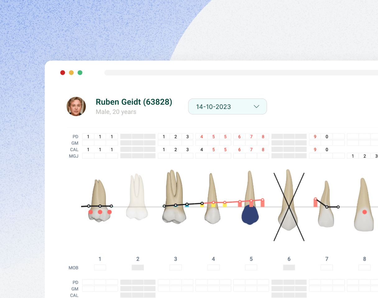 Periodontal Charting