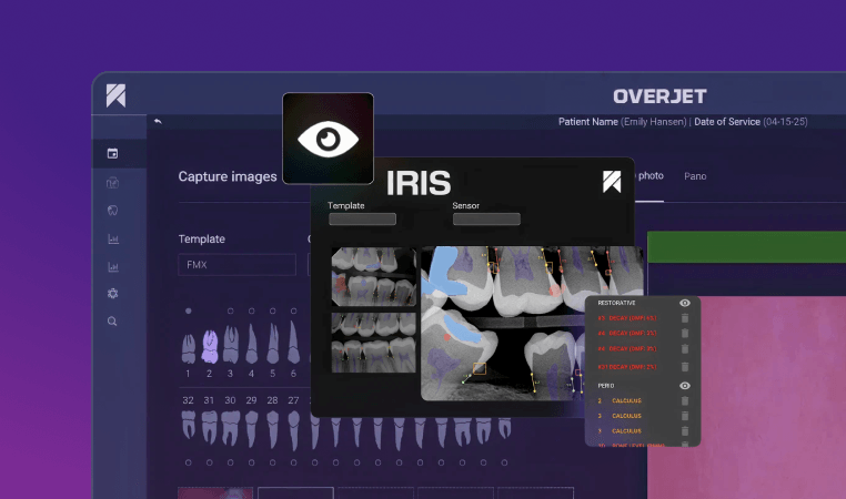 Dental imaging software interface displaying tooth scans, analysis tools, and a sidebar with diagnostic results on a dark background.