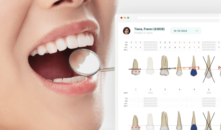 Periodontal examination with a digital dental chart displaying tooth and gum health information.