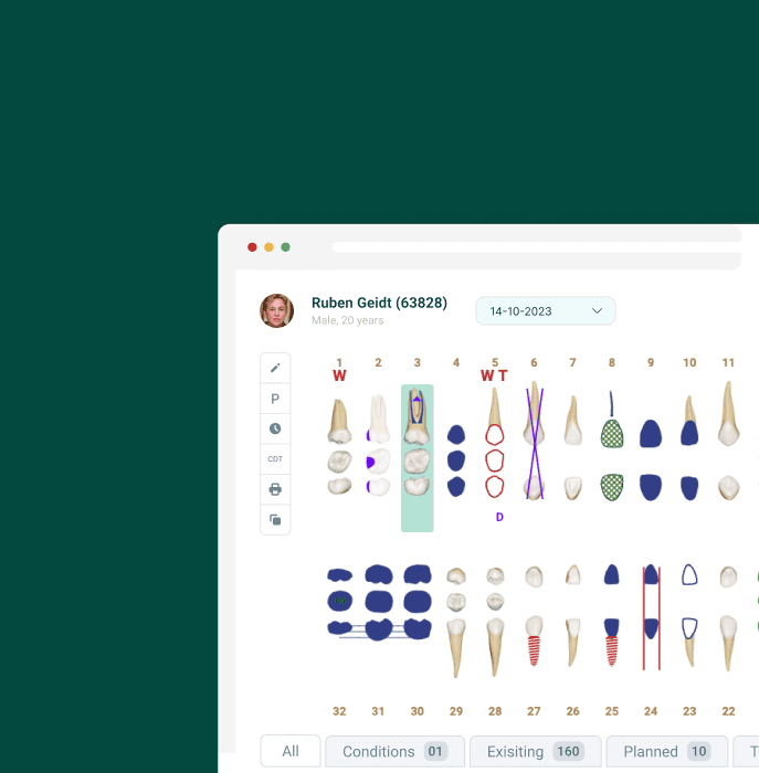 Dental Charting Software Benefits & FAQs CareStack®