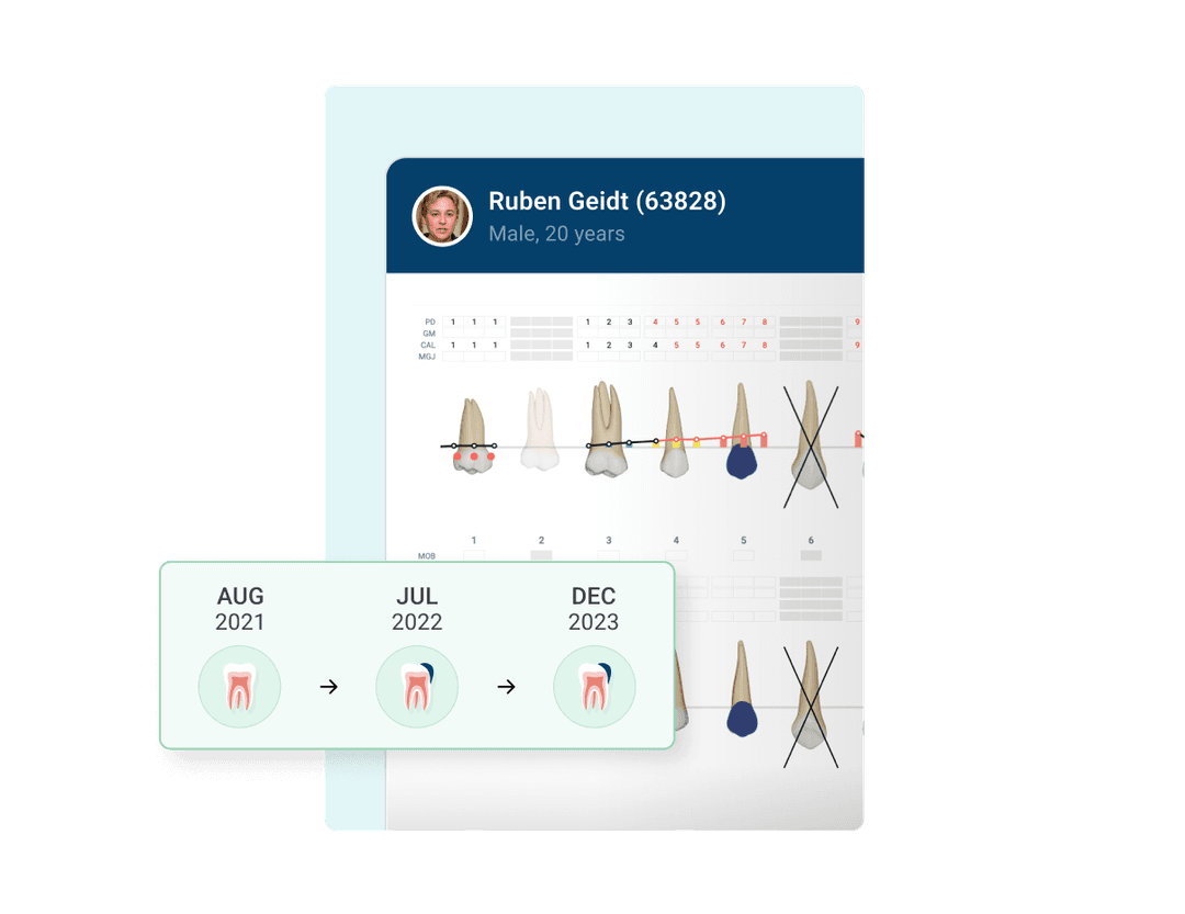 Dental Charting Software Benefits & FAQs CareStack®