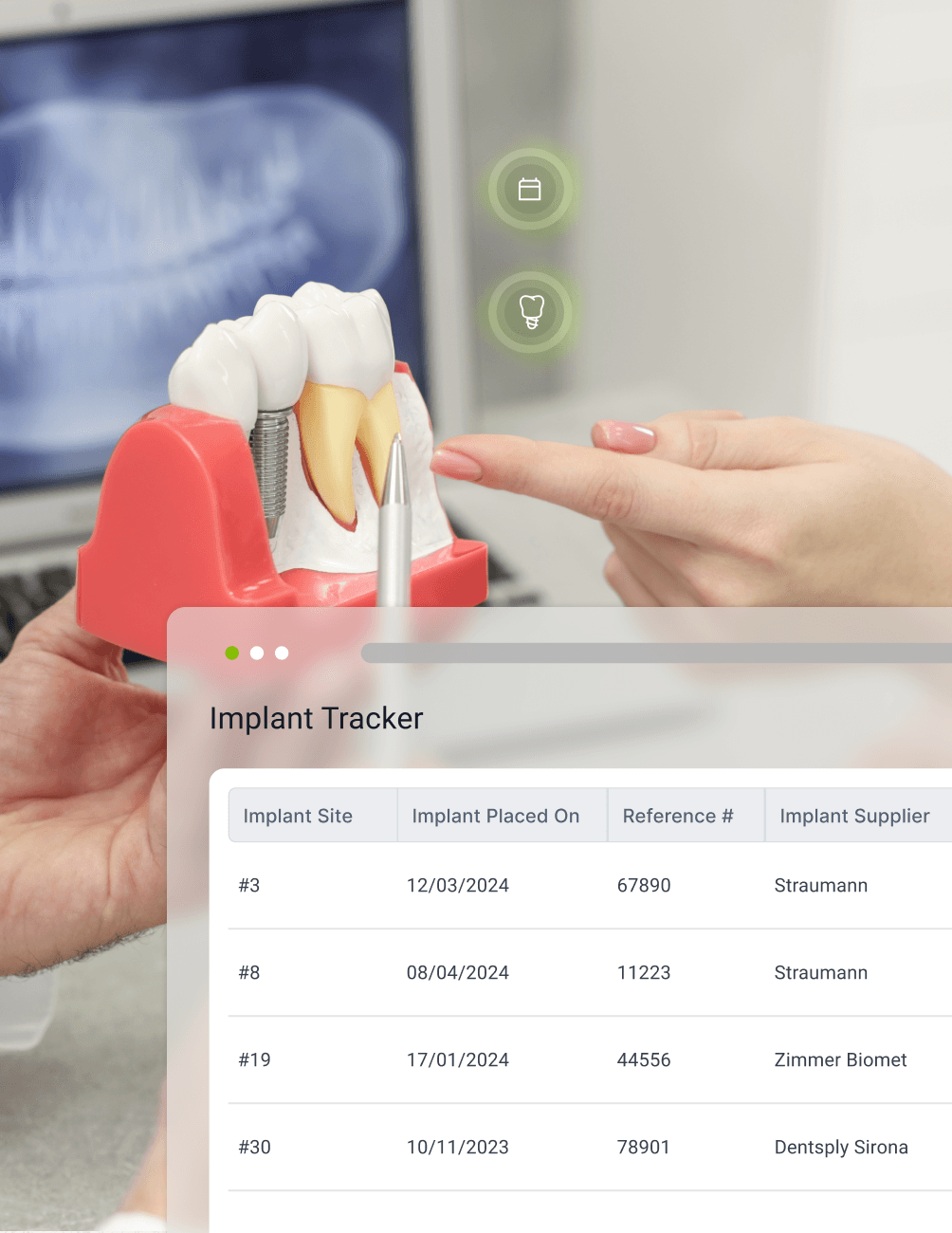 Improved Patient Communication and Care A person points to a dental implant model beside a screen displaying an implant tracker with details like site, date, and supplier.